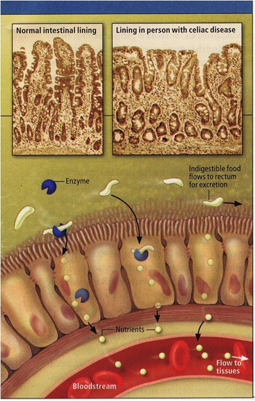 digestion1