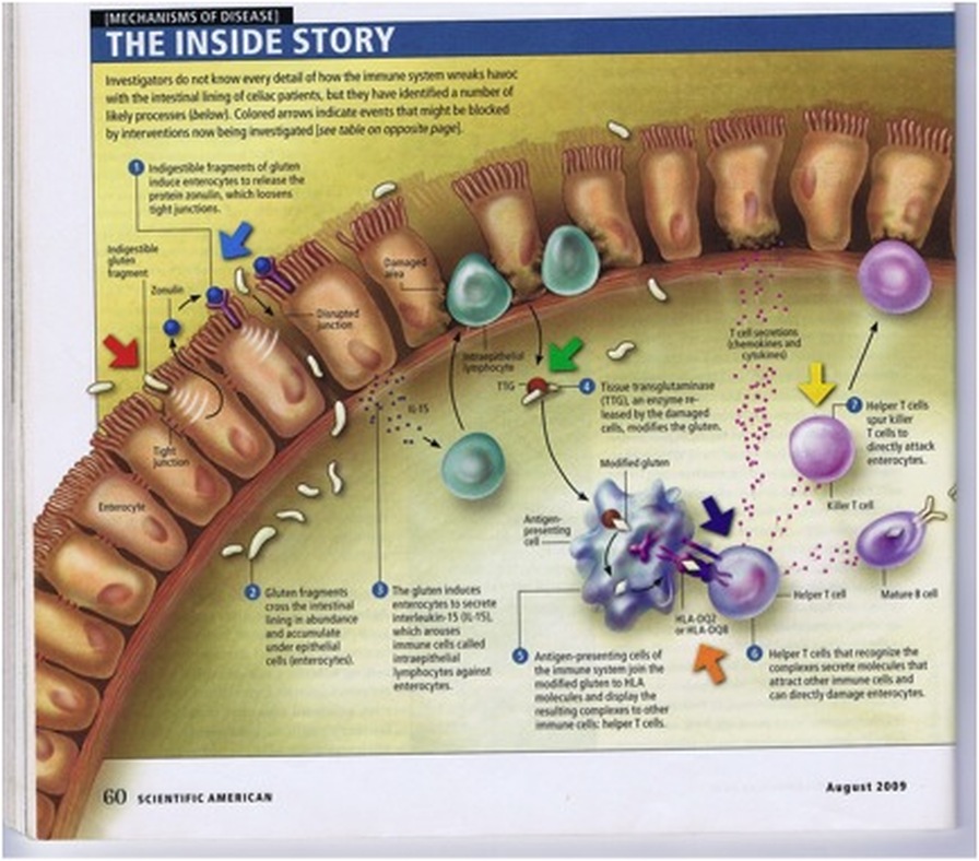 digestion2